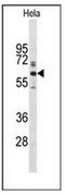 Glypican-1 antibody, AP51865PU-N, Origene, Western Blot image 