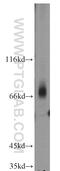 CD5 Molecule antibody, 17227-1-AP, Proteintech Group, Western Blot image 
