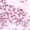 c-Myc antibody, orb214283, Biorbyt, Immunohistochemistry paraffin image 