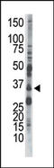 Protein Kinase AMP-Activated Non-Catalytic Subunit Beta 2 antibody, AP13598PU-N, Origene, Western Blot image 