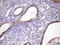 Methylmalonyl-CoA Epimerase antibody, LS-C791685, Lifespan Biosciences, Immunohistochemistry paraffin image 
