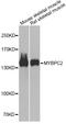 Myosin Binding Protein C, Fast Type antibody, LS-C748386, Lifespan Biosciences, Western Blot image 