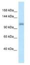 Zinc finger RNA-binding protein antibody, NBP1-82402, Novus Biologicals, Western Blot image 