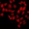 Nudix Hydrolase 6 antibody, LS-C668365, Lifespan Biosciences, Immunofluorescence image 