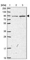 Malignant Fibrous Histiocytoma Amplified Sequence 1 antibody, PA5-62347, Invitrogen Antibodies, Western Blot image 