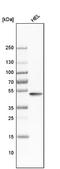 Vasodilator Stimulated Phosphoprotein antibody, NBP1-85792, Novus Biologicals, Western Blot image 