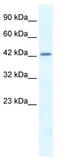 Heat Shock Transcription Factor Family, X-Linked 2 antibody, TA339483, Origene, Western Blot image 