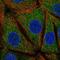 Vacuole Membrane Protein 1 antibody, HPA064780, Atlas Antibodies, Immunofluorescence image 
