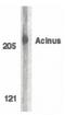 Apoptotic Chromatin Condensation Inducer 1 antibody, PA5-19948, Invitrogen Antibodies, Western Blot image 