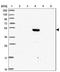 5-Hydroxytryptamine Receptor 3E antibody, NBP2-33578, Novus Biologicals, Western Blot image 