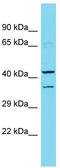 Diencephalon/Mesencephalon Homeobox 1 antibody, TA329976, Origene, Western Blot image 