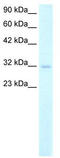 Homeobox protein MSX-1 antibody, TA329262, Origene, Western Blot image 