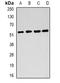 Dihydrolipoamide Dehydrogenase antibody, orb340908, Biorbyt, Western Blot image 