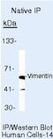 Vimentin antibody, MA5-11883, Invitrogen Antibodies, Immunoprecipitation image 