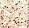 Aurora Kinase B antibody, LS-C100776, Lifespan Biosciences, Immunohistochemistry frozen image 
