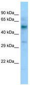 Hepatic lipase antibody, TA343317, Origene, Western Blot image 