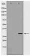 Homeobox protein Hox-B5 antibody, TA347918, Origene, Western Blot image 