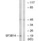 Splicing Factor 3b Subunit 6 antibody, A10990, Boster Biological Technology, Western Blot image 