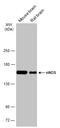 NOS1 antibody, GTX132857, GeneTex, Western Blot image 