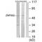 Zinc Finger Protein 682 antibody, A16546, Boster Biological Technology, Western Blot image 