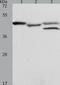 26S proteasome non-ATPase regulatory subunit 6 antibody, TA322367, Origene, Western Blot image 