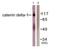 Catenin Delta 1 antibody, TA313210, Origene, Western Blot image 