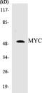 c-Myc antibody, EKC1391, Boster Biological Technology, Western Blot image 