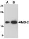 Lymphocyte antigen 96 antibody, TA319869, Origene, Western Blot image 