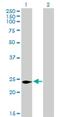 Cell Death Inducing P53 Target 1 antibody, H00029965-B01P, Novus Biologicals, Western Blot image 