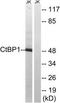 C-Terminal Binding Protein 1 antibody, TA313245, Origene, Western Blot image 