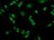 Phosphoglycerate Mutase 2 antibody, MA5-25671, Invitrogen Antibodies, Immunocytochemistry image 