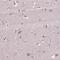 Carnitine O-palmitoyltransferase 1, brain isoform antibody, NBP2-68811, Novus Biologicals, Immunocytochemistry image 