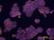 ANTXR Cell Adhesion Molecule 1 antibody, AF3886, R&D Systems, Immunocytochemistry image 