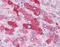 Glucagon receptor antibody, NLS4258, Novus Biologicals, Immunohistochemistry paraffin image 