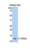 S100 Calcium Binding Protein A11 antibody, LS-C297498, Lifespan Biosciences, Western Blot image 