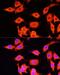Serpin Family A Member 12 antibody, LS-C749172, Lifespan Biosciences, Immunofluorescence image 
