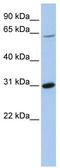 RAK antibody, TA335031, Origene, Western Blot image 