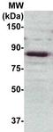 Protein Kinase C Epsilon antibody, TA354274, Origene, Western Blot image 