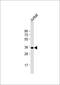 Fructose-Bisphosphatase 1 antibody, GTX81483, GeneTex, Western Blot image 