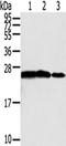RAN, Member RAS Oncogene Family antibody, TA350325, Origene, Western Blot image 