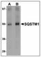 Sequestosome 1 antibody, AP23491PU-N, Origene, Western Blot image 