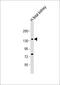 Serine/threonine-protein kinase Nek1 antibody, 63-378, ProSci, Western Blot image 