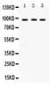 Histone acetyltransferase KAT2A antibody, PB9713, Boster Biological Technology, Western Blot image 