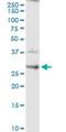Claudin 14 antibody, H00023562-D01P, Novus Biologicals, Western Blot image 