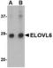 ELOVL Fatty Acid Elongase 6 antibody, TA306564, Origene, Western Blot image 