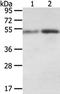 Syntrophin Alpha 1 antibody, TA351777, Origene, Western Blot image 