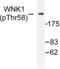 WNK1 antibody, LS-C192172, Lifespan Biosciences, Western Blot image 
