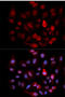 ABL Proto-Oncogene 1, Non-Receptor Tyrosine Kinase antibody, abx000092, Abbexa, Western Blot image 