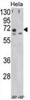 Leiomodin 1 antibody, GTX81141, GeneTex, Western Blot image 