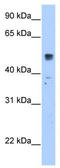 Solute Carrier Family 35 Member F5 antibody, TA333656, Origene, Western Blot image 
